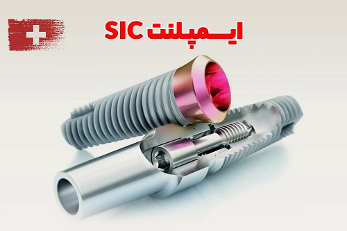 ایمپلنت SIC سوئیس؛ سرمایه‌گذاری برای یک لبخند ماندگار، نه فقط کاشت دندان
