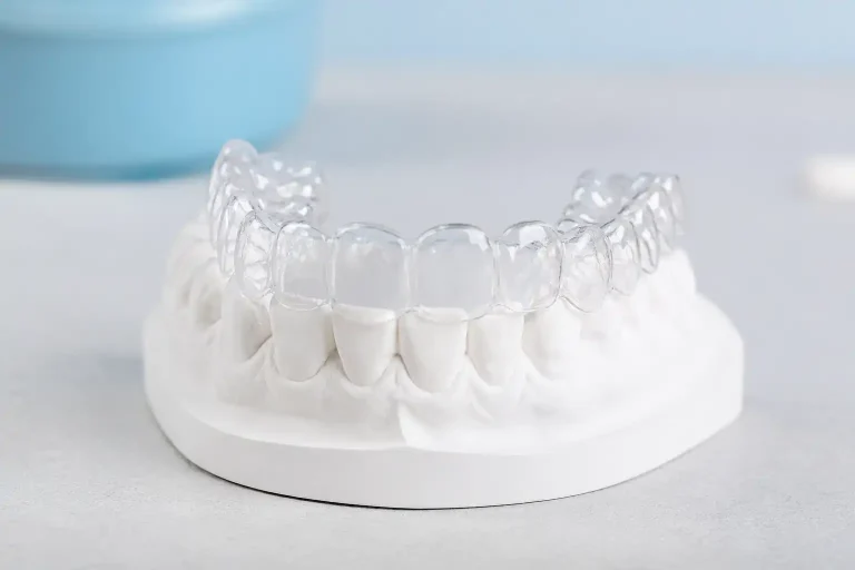 ارتودنسی نامرئی برای بستن فاصله و مرتب کردن دندان‌ها؛ چه مشکلاتی را می‌توان با الاینر درمان کرد؟