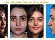 عمل بینی طبیعی چگونه به ایجاد تناسب بیشتر چهره کمک می کند؟