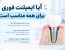 آیا ایمپلنت فوری برای همه مناسب است؟