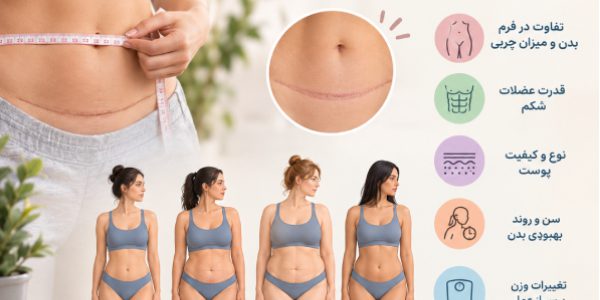 چرا نتیجه ابدومینوپلاستی در افراد مختلف یکسان نیست؟