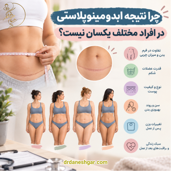 چرا نتیجه ابدومینوپلاستی در افراد مختلف یکسان نیست؟