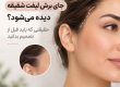 جای برش لیفت شقیقه دیده می‌شود؟ حقیقتی که باید قبل از تصمیم بدانید