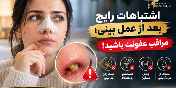 اشتباهات رایج بعد از عمل بینی؛ مراقب عفونت باشید!