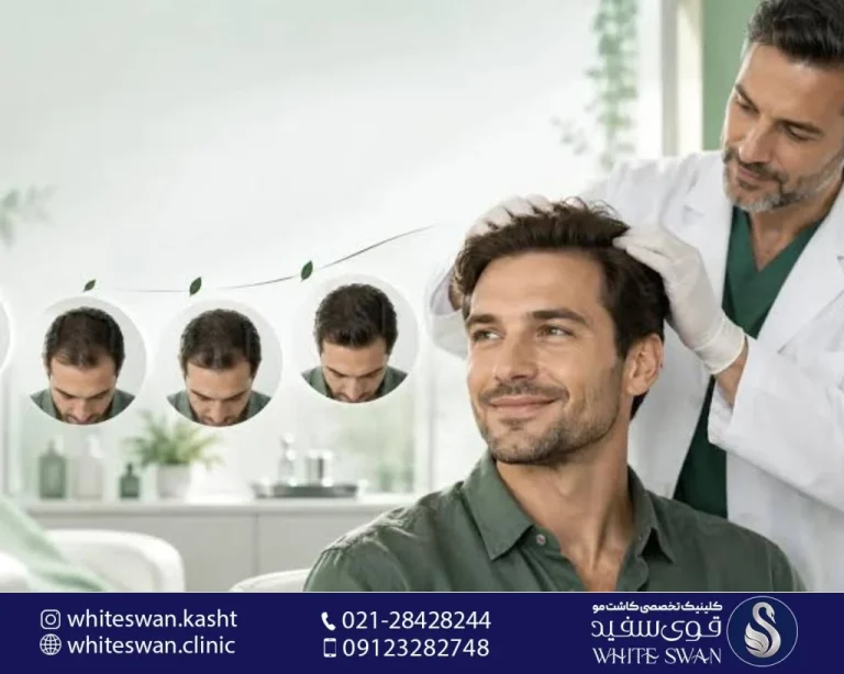 مزوتراپی مو یا کاشت مو؛ کدام روش برای درمان ریزش مو مناسب‌تر است؟