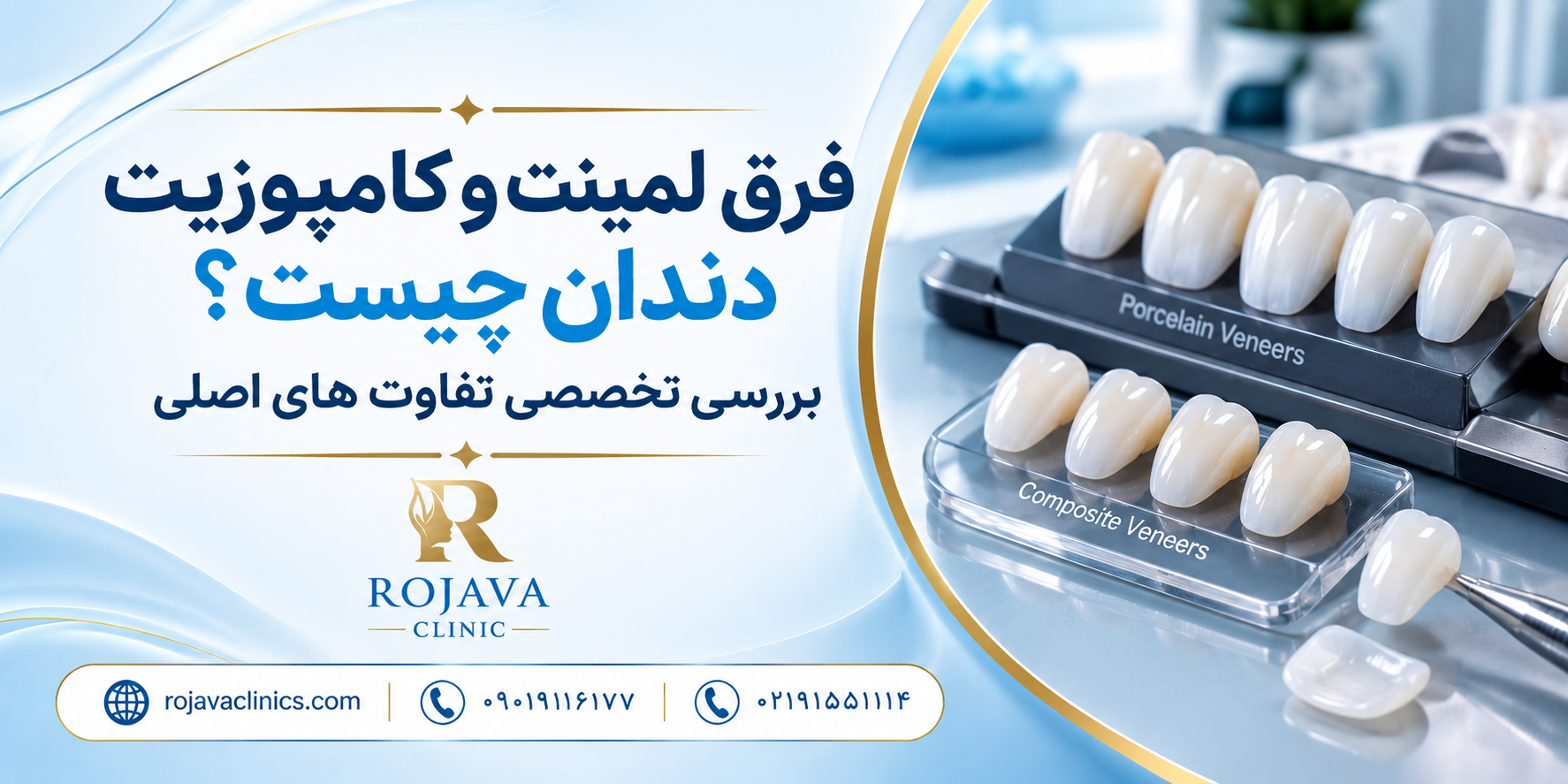 مقایسه لمینت و کامپوزیت دندان؛ از هزینه تا ماندگاری و مراقبت