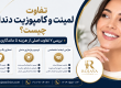 11 تفاوت لمینت و کامپوزیت دندان؛ مقایسه کامل + مزایا و معایب