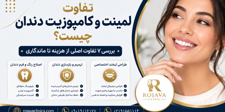 11 تفاوت لمینت و کامپوزیت دندان؛ مقایسه کامل + مزایا و معایب