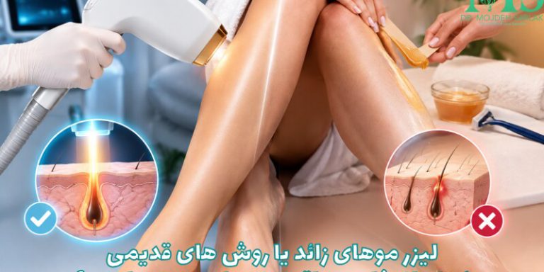 لیزر موهای زائد یا روش های قدیمی؛ کدام انتخاب منطقی تری برای پوست است؟
